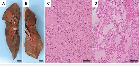 Autopsy Findings Of The Lungs A B Macroscopic Observation After