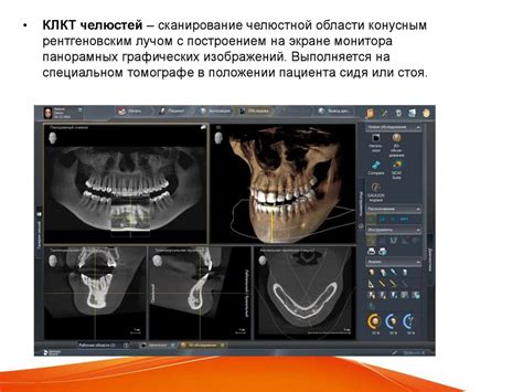 Лучевая диагностика в стоматологии - презентация онлайн