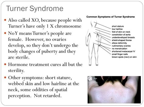 Ppt Genetic Disorders Sex Linked Traits Powerpoint Presentation Id