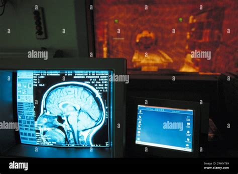 Magnetic Resonance Scan Stock Photo Alamy