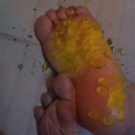 Thao And Candles Gay Asian HD Porn Video 38 XHamster XHamster