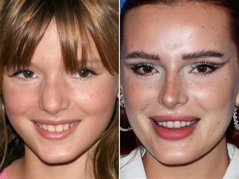 Bella Thorne Nose Job Unraveling The Truth Cosmeticium