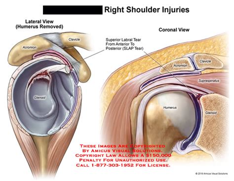 Medical Exhibits Demonstrative Aids Illustrations And Models