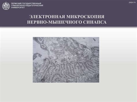 Нервно-мышечный аппарат - презентация онлайн