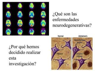 Enfermedades Neurodegenerativas Ppt