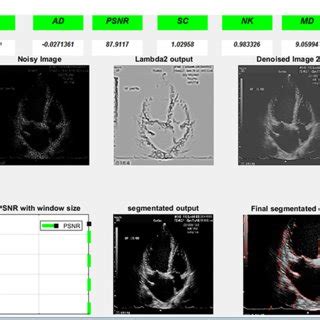 echo image analysis  detailed approach  image processing