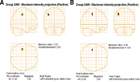 Figure 1 From Sex Differences In Sensorimotor Mu Rhythms During