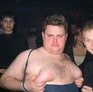 Worlds Ugliest Tits Competition Literotica Discussion Board