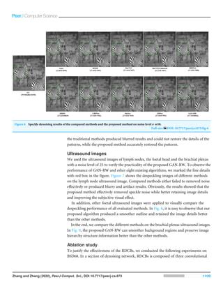 Ultrasound Image Denoising Using Generative Adversarial Networks With