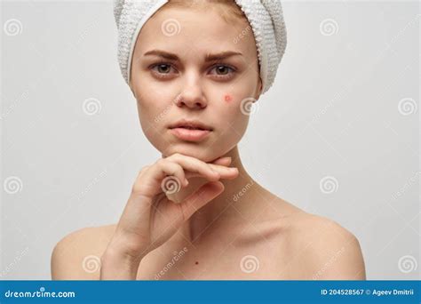 Woman With Towel On Head Naked Shoulders Clear Skin Acne Spa Treatments Stock Image Image Of