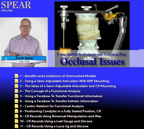 SPEAR Using Models To Evaluate and Treatment Plan Occlusal Issues