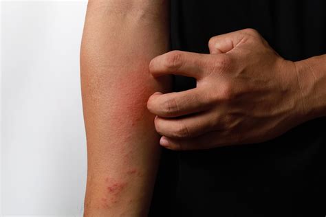 Specially Designed Fabric Helps Maintain Skin Homeostasis For Those