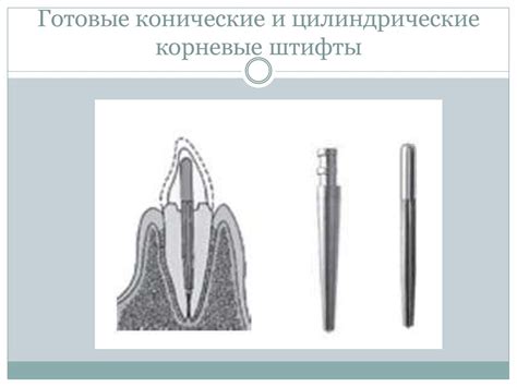 Штифты. Стоматология - презентация онлайн