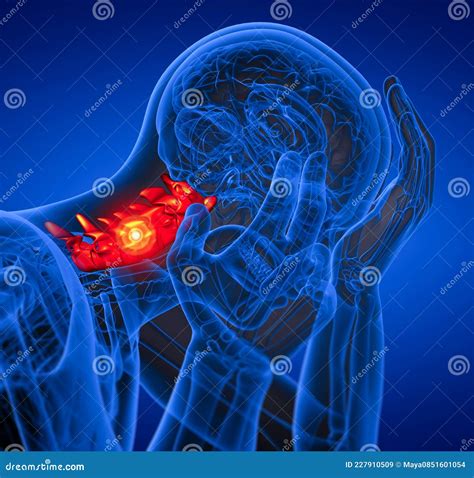 D Render Medical Illustration Of The Cervical Spine Stock Illustration