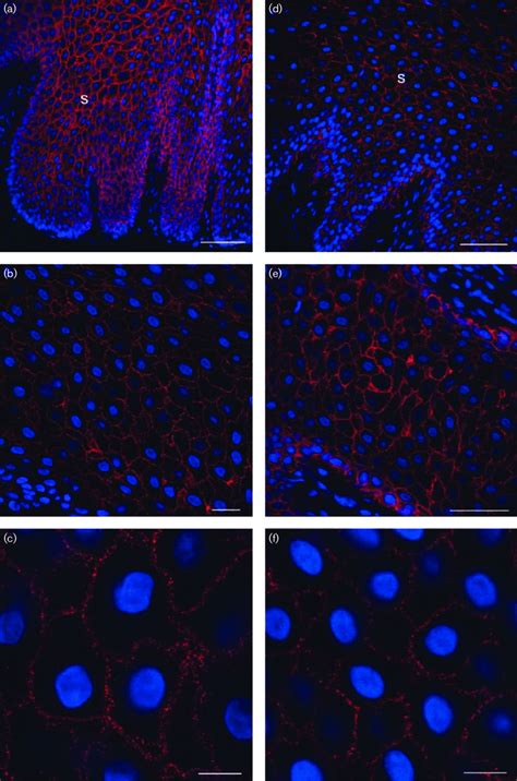 Expression Of Avb6 In Tongue And Interdigital Skin Epithelium Tissue