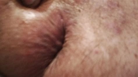 Spun And Playing With My Asshole And My Chem Cock Nude Pics Xhamster