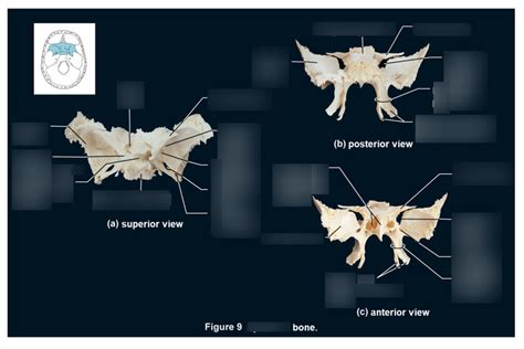 Sphenoid Bone Labeling Diagram Quizlet