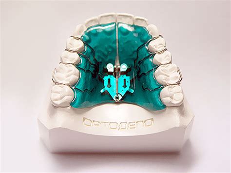 Знімні ортодонтичні апарати – Про зуби