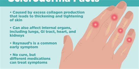 Unveiling The Mystery Understanding The Enigma Of Scleroderma B7 Clinics