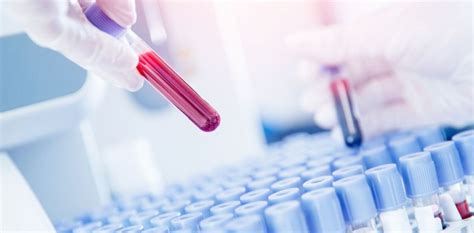 Quanto Tempo Leva Para O Anticoncepcional Sair Do Organismo