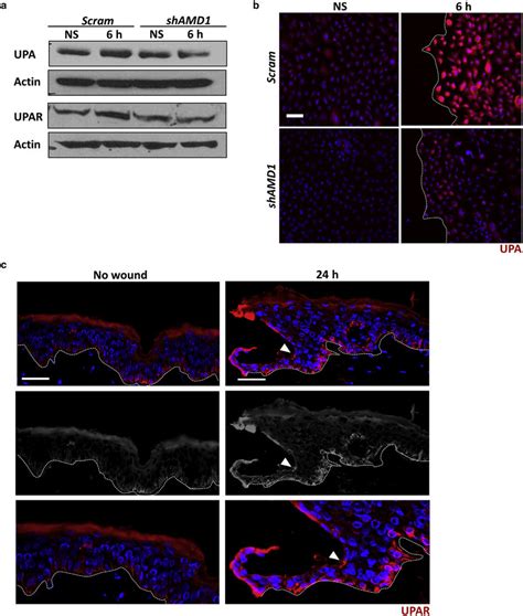 Amd Is Required For Upa Upar Signaling And Actin Cytoskeletal