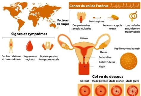 Mesdames Nignorez Plus Ces 3 Signes Du Cancer Du Col De Lutérus