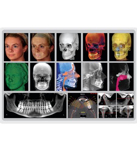 Orthognathic Surgery Fms Dental Hospital