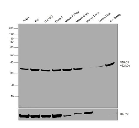 Vdac Recombinant Rabbit Monoclonal Antibody Invitrogen 100 μl