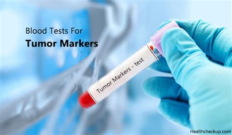 What Are Cancer Markers | Blood Tests for Cancer Markers