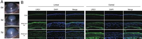Lrg Was Increased In Alkali Burned Corneas A Representative Slit Lamp