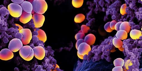 Staphylococcus Aureus Biofilm