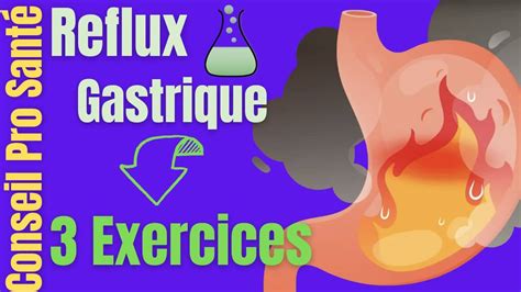 Stop Aux Reflux Gastriques Et Remont E Acide Exercices Faire Chez Soi