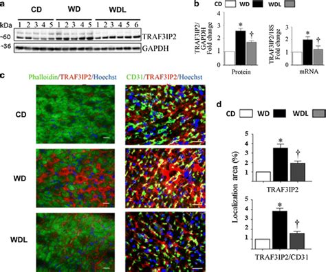 Linagliptin Prevents Wd Induced Increases In Traf Ip Expression A