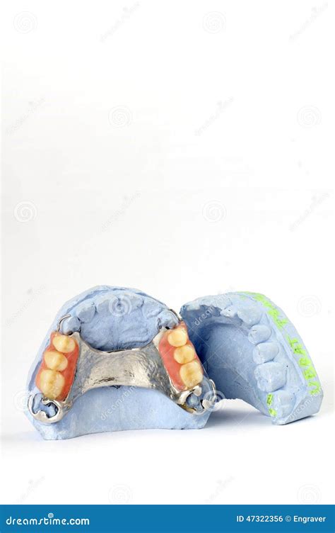 Partial Denture Upper Side On A White Background Stock Photo
