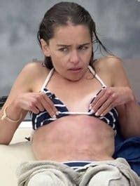Emilia Clarke Sick In Candid Bikini Pics