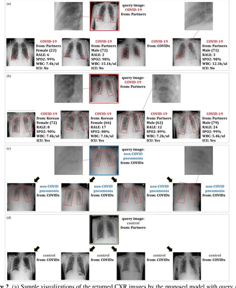 Figure 1 From Deep Metric Learning Based Image Retrieval System For