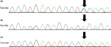 CDC42 c.68A>G variant validation through Sanger sequencing. A ...