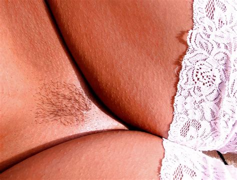 Sun Bakeing In White Lace Top Stockings Porn Pictures XXX Photos Sex Images 671119 PICTOA