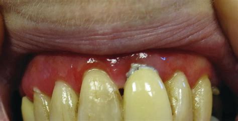 Other Dermatoses Obgyn Key