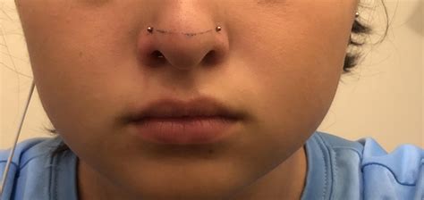 Does My Nose Piercing Look Uneven Rpiercingadvice