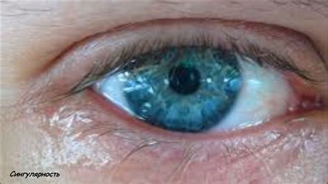 Жжение в глазах и слезотечение: причины зуда, лечение капями, слезятся ...