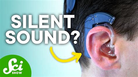 What A Cochlear Implant Actually Sounds Like Youtube