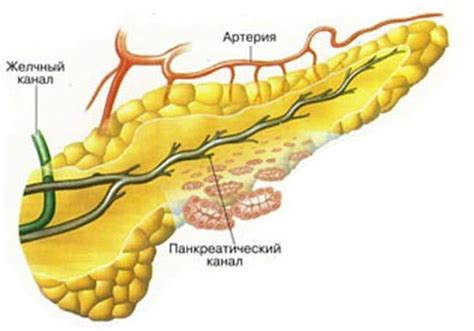 Деструктивний панкреатит: що це таке і як це лікувати?