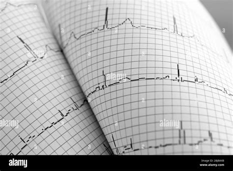 Electrocardiogram in paper form, closeup Stock Photo - Alamy