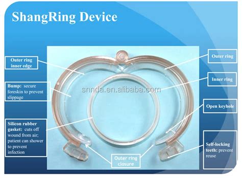 plastibell procedure