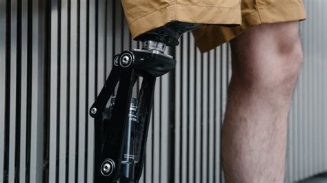 3d Prosthetic Hand Printing