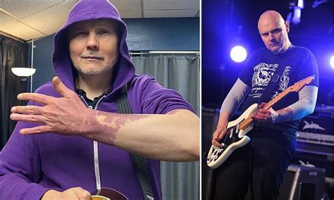 Smashing Pumpkins frontman Billy Corgan shares his private pain over