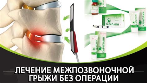 Карипаин гель и крем: подробная инструкция по применению, состав ...