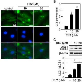 Rb2 Controls Autophagy In Senescent HDFs A B Measuring LC3 Puncta