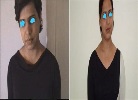 Sex Change Surgery Process Gender Dysphoria Vidya Rajput